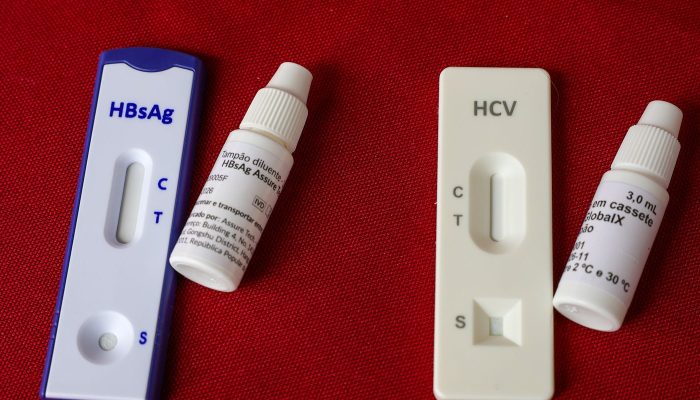 dia-mundial-de-luta-contra-as-hepatites-virais-alerta-para-prevencao1785238579.jpg