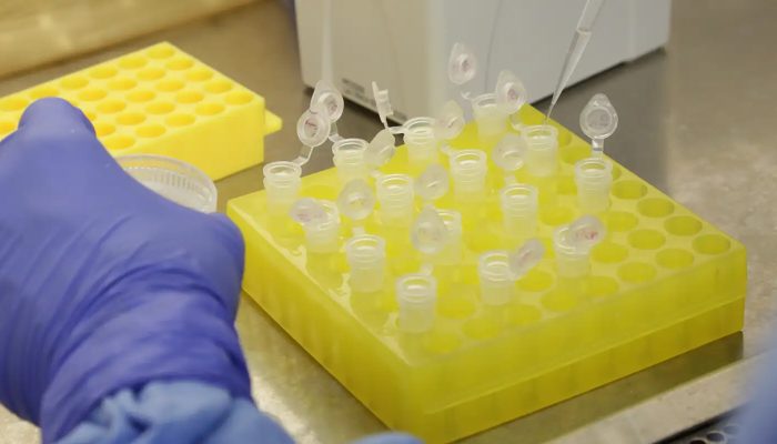 diagnostico_laboratorial_de_casos_suspeitos_do_novo_coronavirus_2801209411.jpg