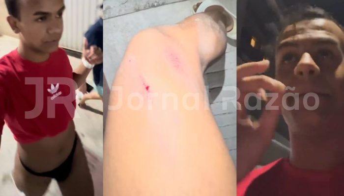 jovem-denuncia-homofobia-ataque-pitbull-balneario-camboriu.jpg
